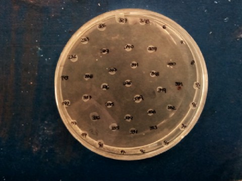 Con financiamiento del Gobierno provincial, investigan resistencia bacteriana en la Patagonia